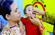 ভিটামিন ‘এ প্লাস’ ক্যাম্পেইন  শুরু আজ থেকে শিশুদের